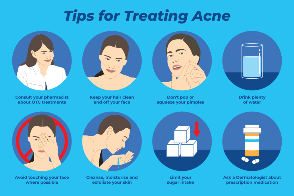 An illustration displaying tips and advice for treating acne on the skin. Acne can be treated by following these tips: don’t pop or squeeze your pimples, avoid making contact with your face where possible, limiting your sugar intake, drinking plenty of water, cleansing, moisturising and exfoliating your skin, keeping your hair clean and off your face, ask your dermatologist for prescription medicine and ask your pharmacist about any OTC treatments.